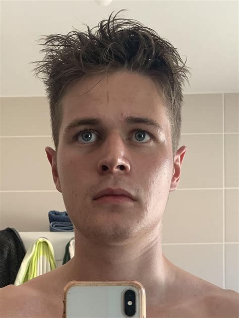 2.5 years of mewing progress from 27-29 : r/Mewing