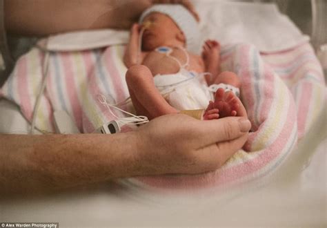 Mother photographs premature baby's battle for survival | Daily Mail Online