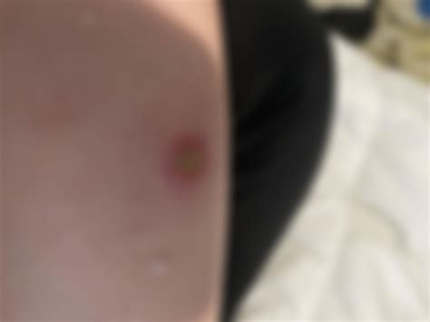 Does that look infected those white dead skin looking things are