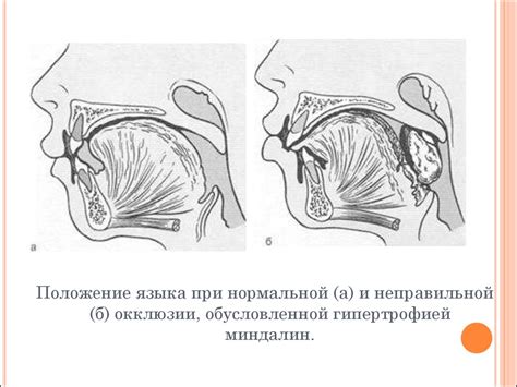 Принципы и способы ортодонтического лечения зубочелюстные аномалии ...