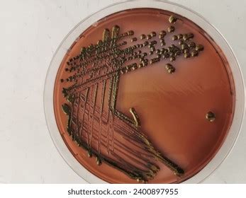 eosin methylene blue  royalty  images stock