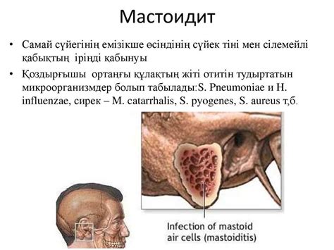 Сосцевидный отросток височной кости - где находится, характеристика и ...