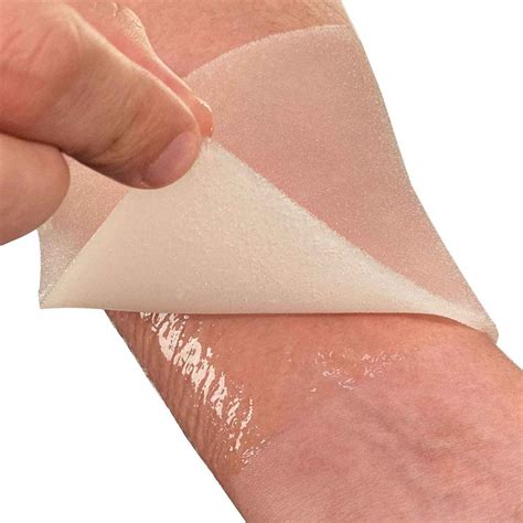 Burn Dressing 10cmx10cm: Effective Treatment for Burns