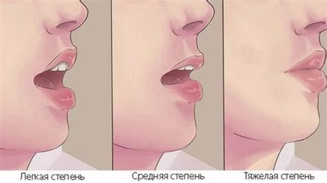 Спазм челюсти: причины и решение проблемы