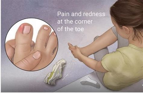 Don’t Ignore your Toe Pain.