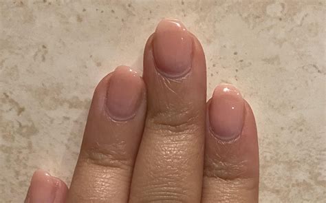 how to fix curving nails