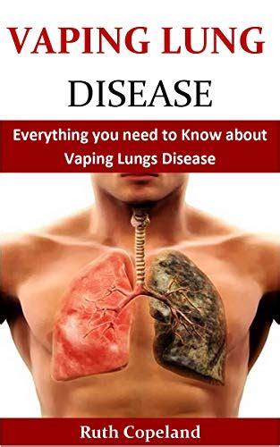 VAPING LUNG DISEASE: Everything you need to Know about Vaping Lungs ...