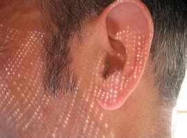 Зуд в ушах. Причины и методы лечения