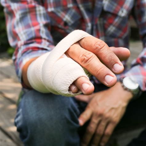 workers comp  hand  finger injuries calhoon  kaminsky pc