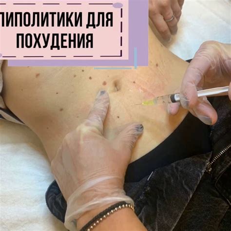 Косметолог | Губы | Ботокс Спб | ЛИПОЛИТИКИ ДЛЯ ПОХУДЕНИЯ Липолитики ...