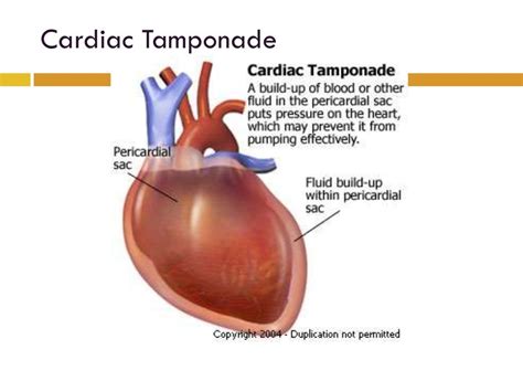 Pericardium Anatomy
