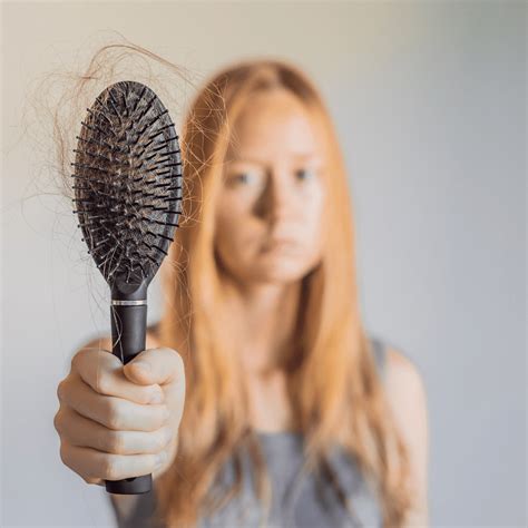 topical hair loss treatments 14