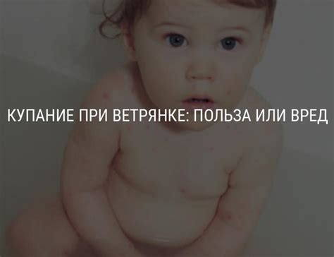 Купание при ветрянке: можно ли купать ребенка, когда можно купаться ...