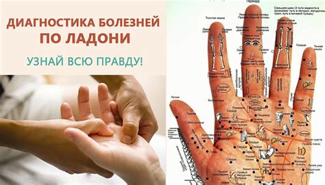 Оказывается, по ладоням можно не только предсказывать будущее, но и ...