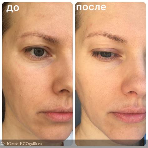 Лифтинг сыворотка с ретинолом Skinjestique “Retinol Anti-aging serum“
