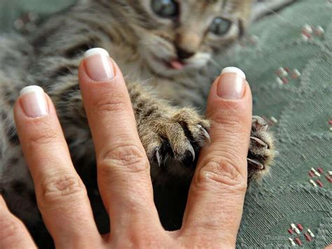 Cat Scratch Disease: Cat Scratch Disease Symptoms, Treatments & More