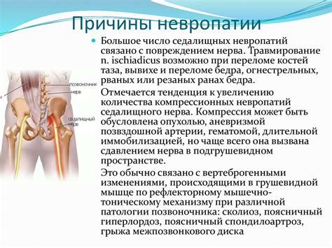Невропатия седалищного, малоберцового и большеберцового нервов - online ...