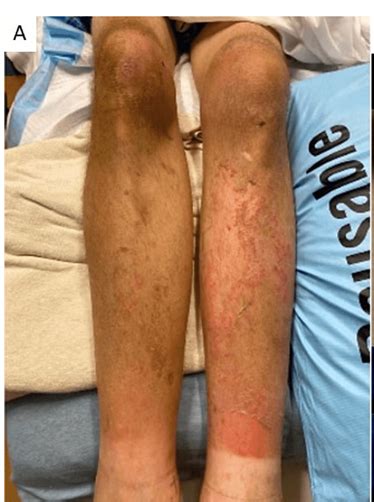 cases  scurvy highlighted   report donovan hair clinic