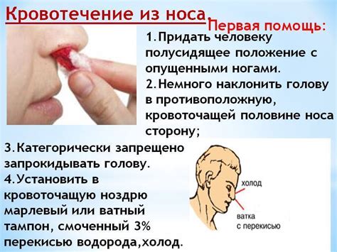 Кровь из носа: причины у взрослого и методы лечения дома