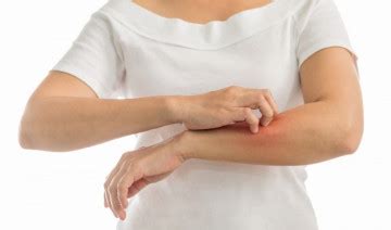 Allegra Vs. Claritin: Which Is Better For Itching?