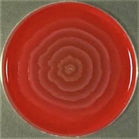 Morphology & Culture Characteristics of Proteus Vulgaris