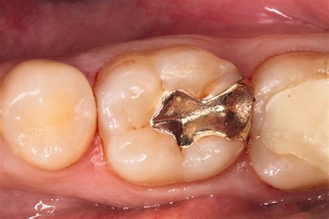 dent update: Praxiswissen pur - dentalmagazin.de