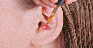 how to get a pimple out of your ear