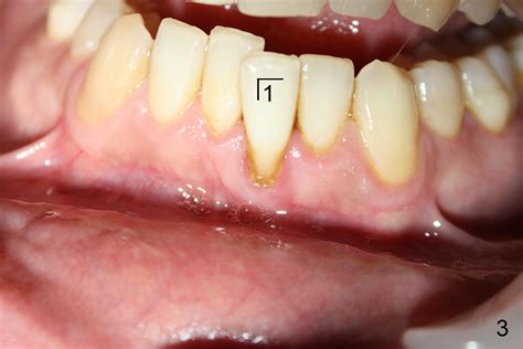 Dental Education Lecture