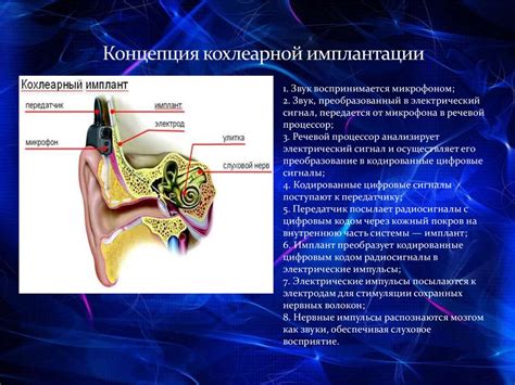 Кохлеарная имплантация - презентация онлайн