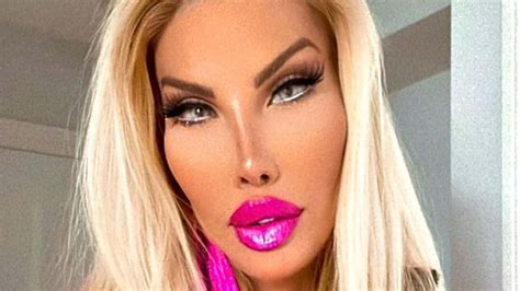 nikki plastic surgery