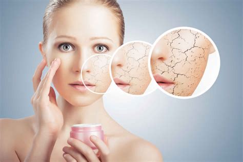 Xerosis of skin causes, symptoms, diagnosis & xerosis treatment