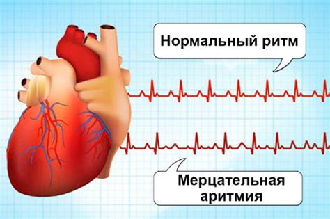 Аритмия сердца у мужчин и женщин: причины, признаки, лечение, последствия