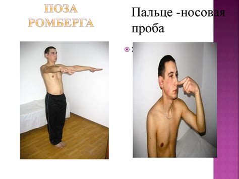 Мозжечок, синдромы поражения. Экстрапирамидная система, синдромы ...