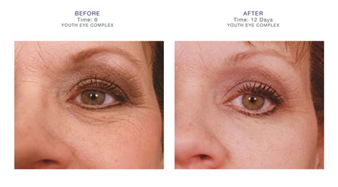 Wrinkles, puffiness and dark under-eye circles got you down? Check out