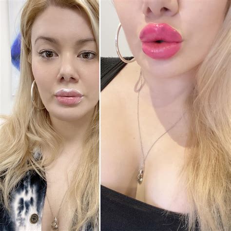 3412 best r/bimbofication images on Pholder | NEW big juicy lips for