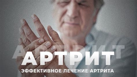 АРТРИТ | Как лечить артрит | Реабилитация пожилого человека после ...