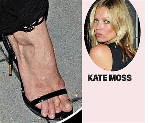 Celebrities with Ugly Feet (15 pics)