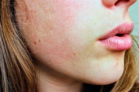 Porcelain Skin Tone Defined (With Pictures) - Skin Care Geeks