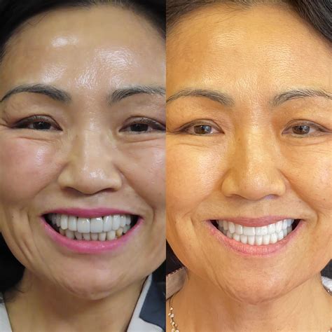 Queen Anne Dentistry - David M Arndt Dds Ps 5