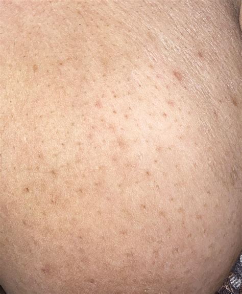 Is it normal for breast skin to look like this? It’s been like this for