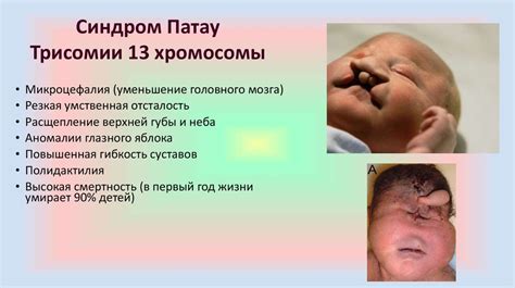 Мутации. Значение мутаций в эволюции - презентация онлайн
