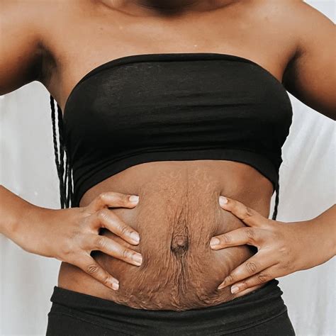 Barriga Pos Parto Antes E Depois - Barriga pós-parto: exercícios para perder, dicas e fotos de antes e depois