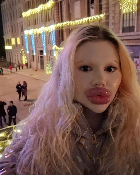 Andrea Ivanova - the woman with the world's largest lips got 6 ...