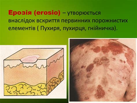 Анатомія та фізіологія шкіри. Первинні та вторинні елементи шкіри ...