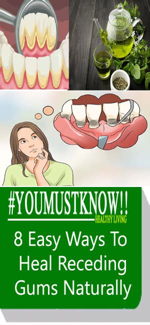 8 Easy Ways To Heal Receding Gums Naturally - nutrition health