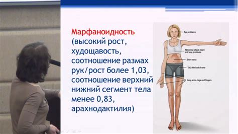 Правдюк Н. Г. Дисплазии соединительной ткани - ревматологические ...