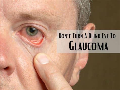 glaucoma management     today  prevent vision loss