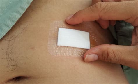 material manufacturing solutions  advanced wound care delstar