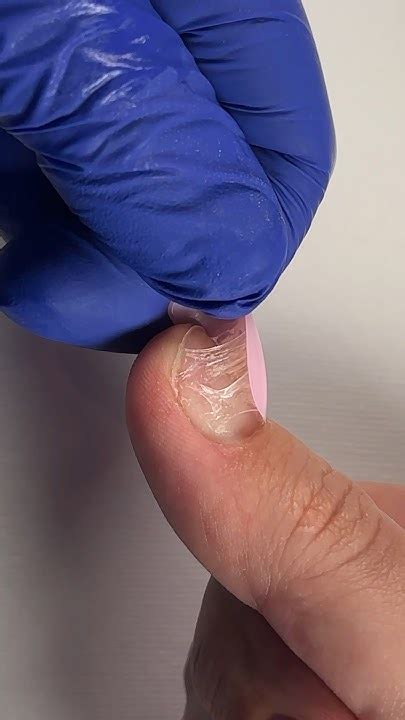 НЕ ДЕЛАЙ ТАК! Отслойки ногтей #ногти #nails - YouTube