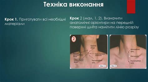 Травми грудної клітки - презентация онлайн